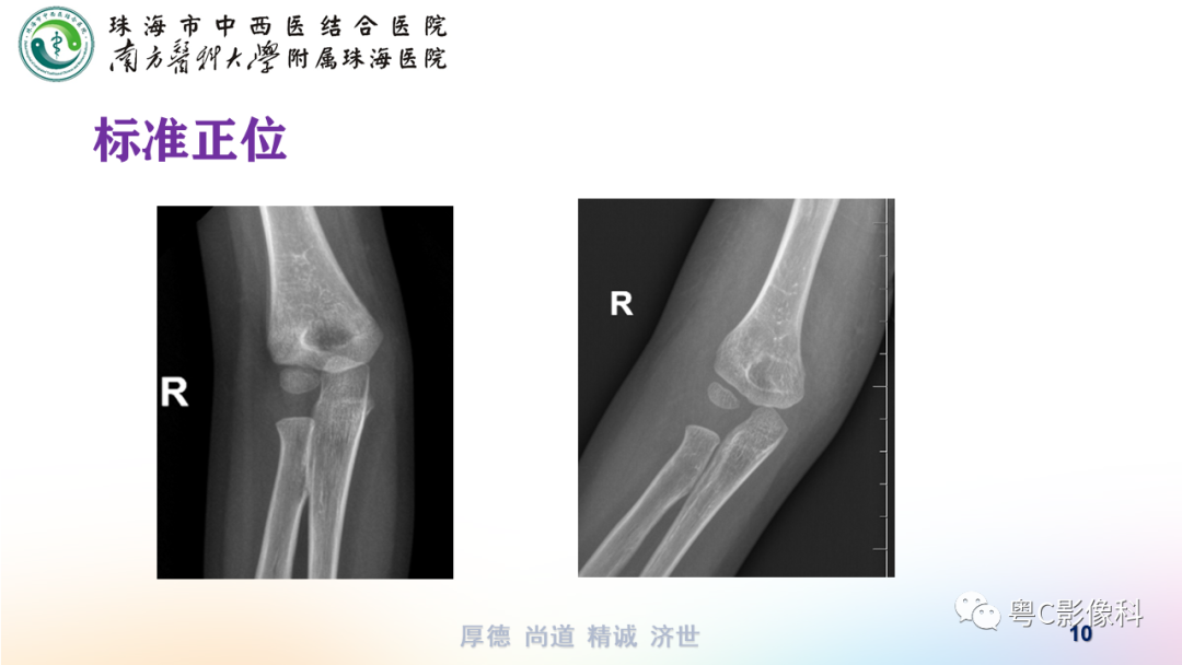 影像PPT - 【PPT】儿童肘关节正侧位x线摄影-10