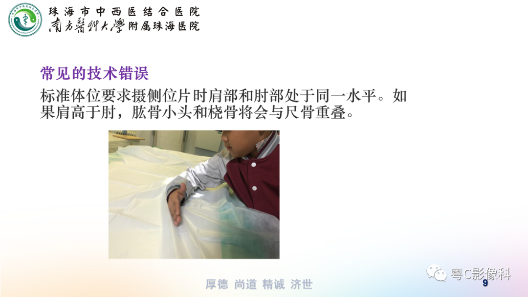 影像PPT - 【PPT】儿童肘关节正侧位x线摄影-9