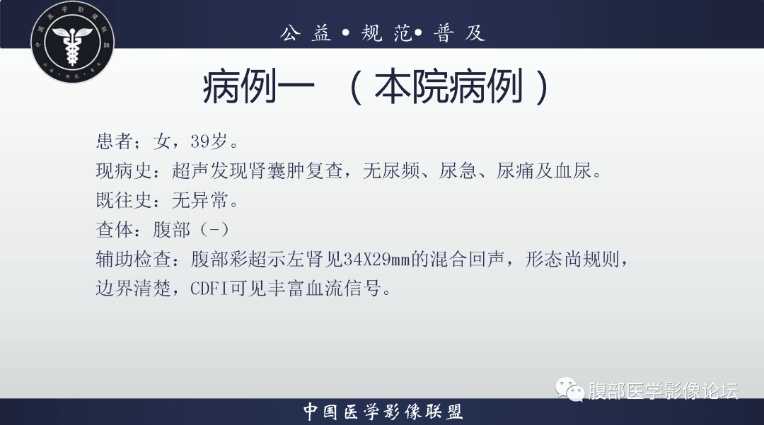 影像PPT - 【病例】肾脏血管平滑肌脂肪瘤1例CT影像-1 影像PPT - 【病例】肾脏血管平滑肌脂肪瘤1例CT影像-1