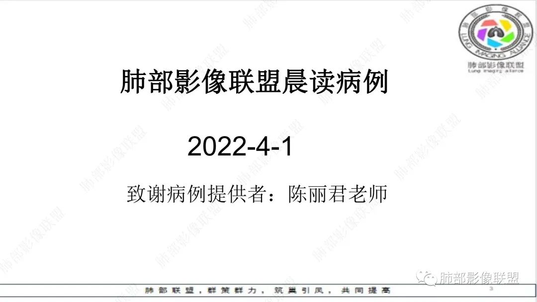 影像PPT - 【病例】精准打击—小细胞肺癌-1 影像PPT - 【病例】精准打击—小细胞肺癌-1