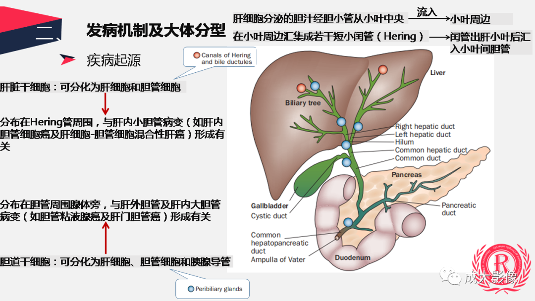 影像PPT - 【PPT】胆管细胞癌影像与临床-5