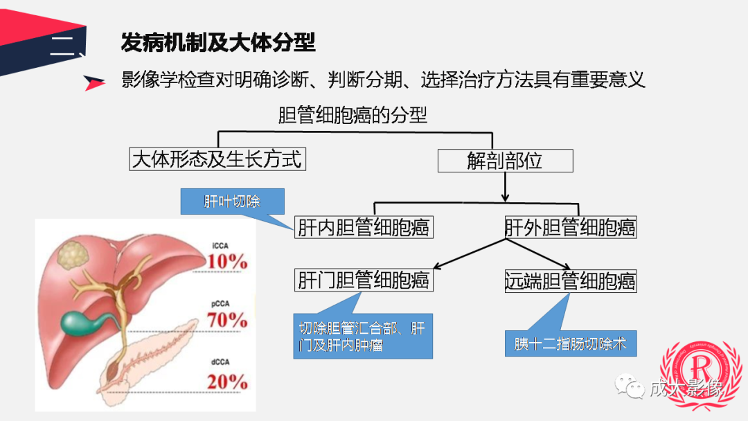 影像PPT - 【PPT】胆管细胞癌影像与临床-8