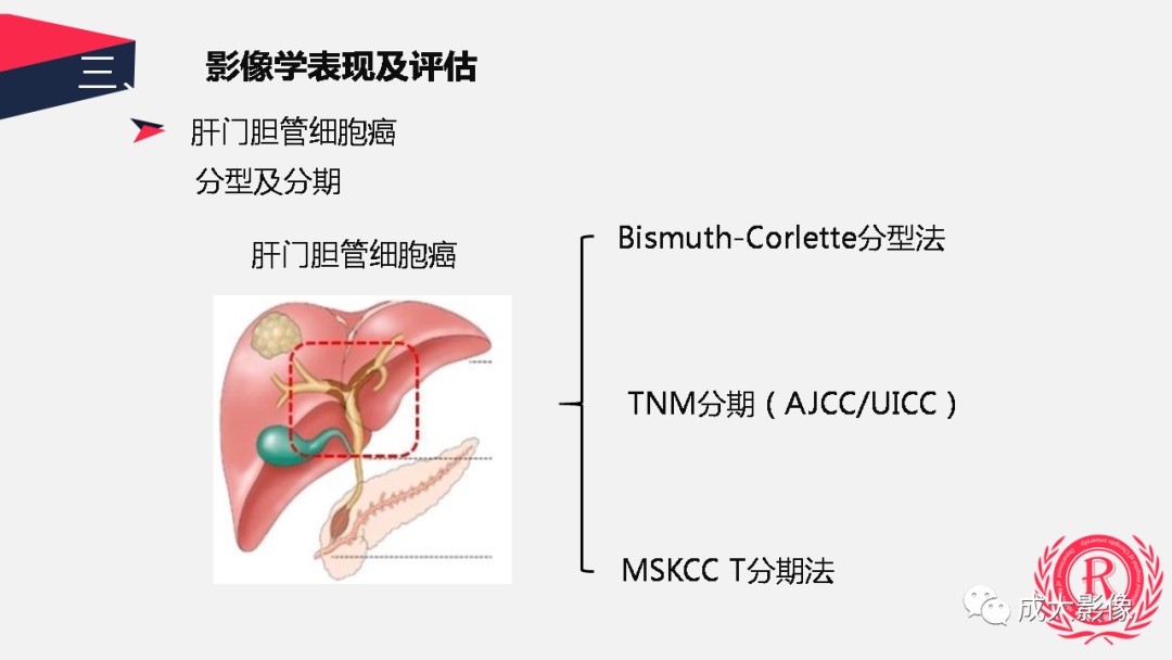 影像PPT - 【PPT】胆管细胞癌影像与临床-10