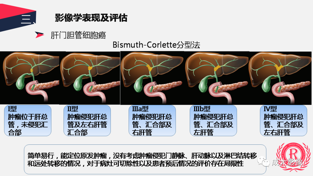 影像PPT - 【PPT】胆管细胞癌影像与临床-13