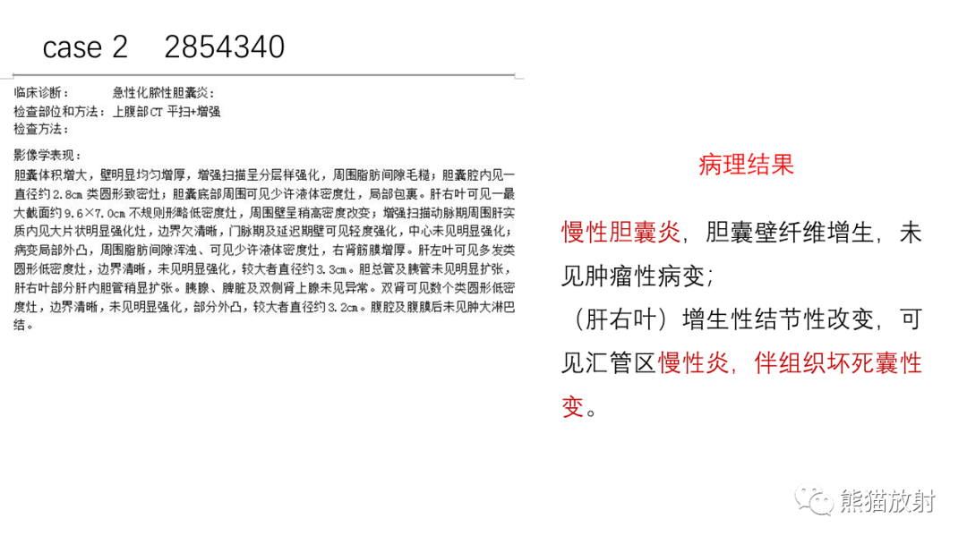 影像PPT - 【病例】肝内胆管细胞癌 VS 慢性炎性灶-38