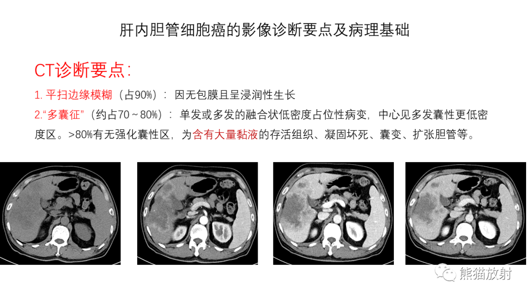 影像PPT - 【病例】肝内胆管细胞癌 VS 慢性炎性灶-42