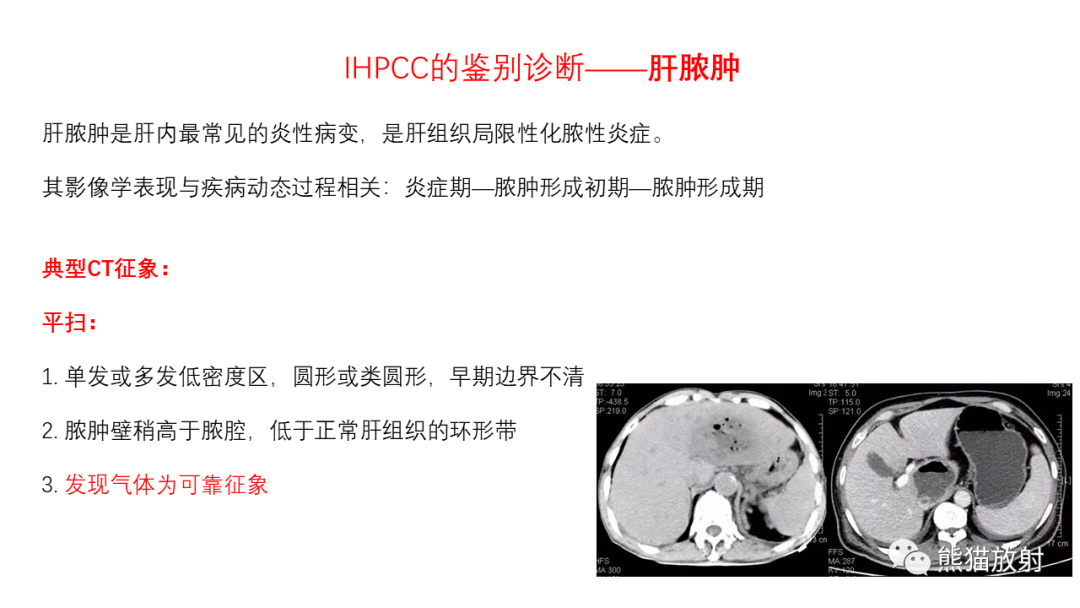 影像PPT - 【病例】肝内胆管细胞癌 VS 慢性炎性灶-46