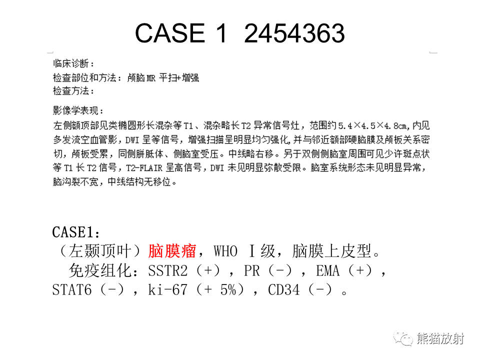 影像PPT - 【病例】脑膜瘤 VS 孤立性纤维瘤-22