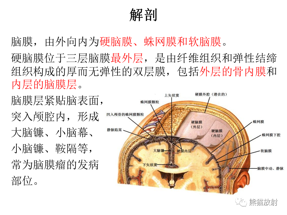 影像PPT - 【病例】脑膜瘤 VS 孤立性纤维瘤-26