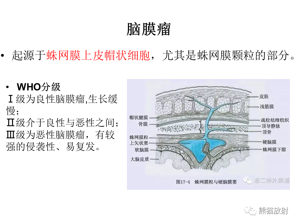 影像PPT - 【病例】脑膜瘤 VS 孤立性纤维瘤-31