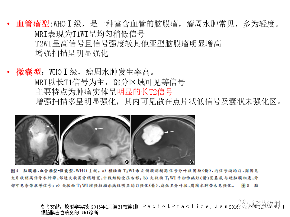 影像PPT - 【病例】脑膜瘤 VS 孤立性纤维瘤-39