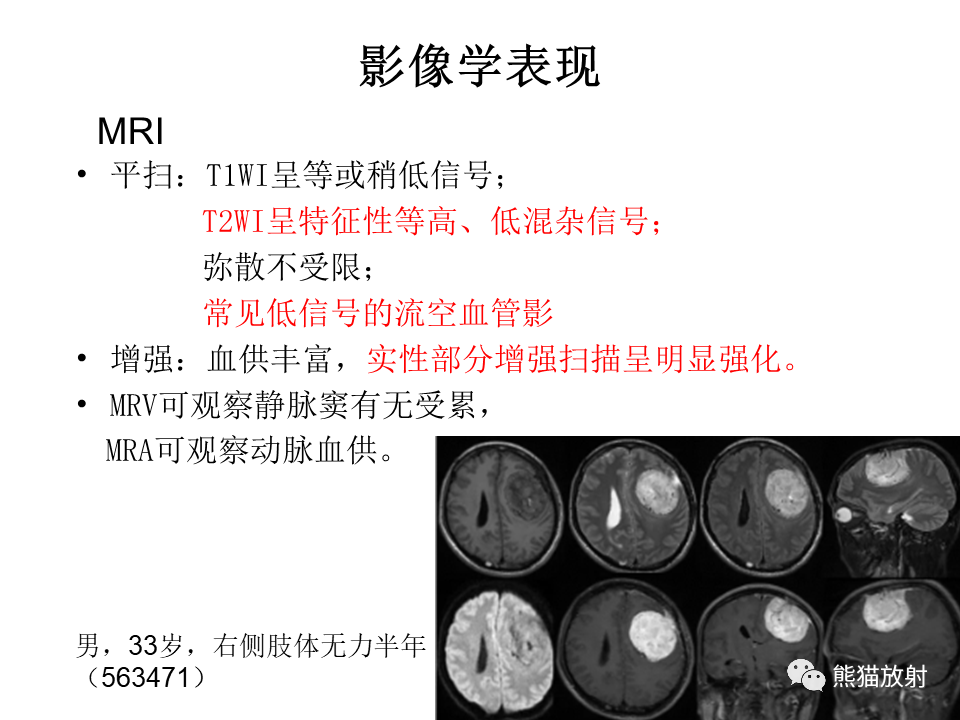 影像PPT - 【病例】脑膜瘤 VS 孤立性纤维瘤-46