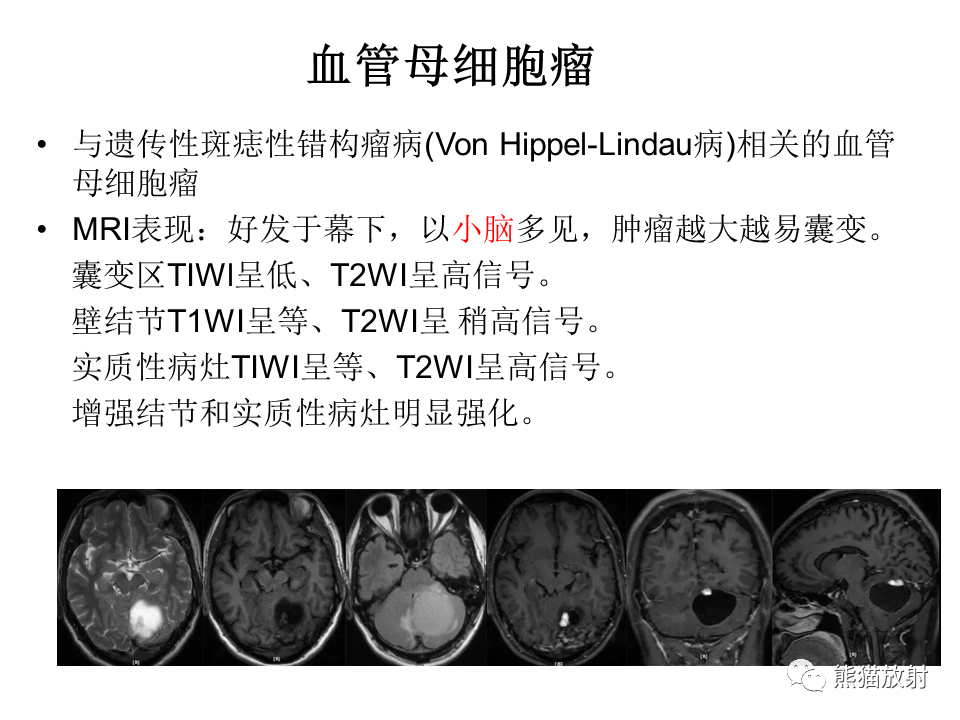 影像PPT - 【病例】脑膜瘤 VS 孤立性纤维瘤-48