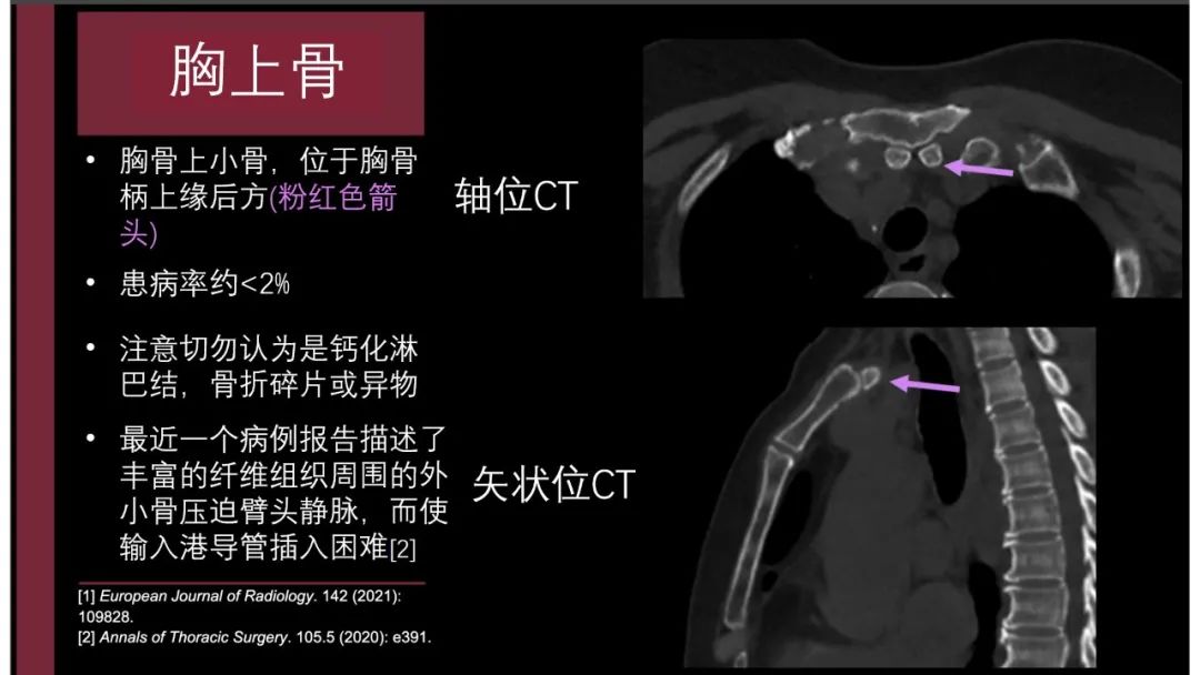 影像PPT - 【PPT】胸骨与胸锁关节-12