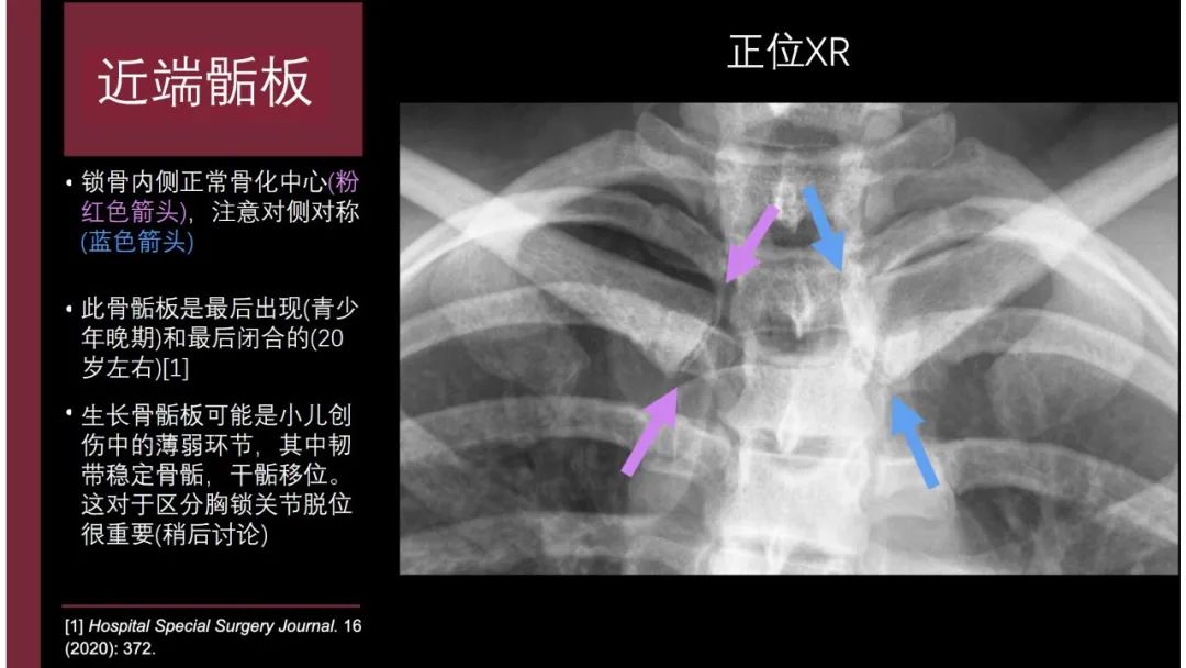 影像PPT - 【PPT】胸骨与胸锁关节-18
