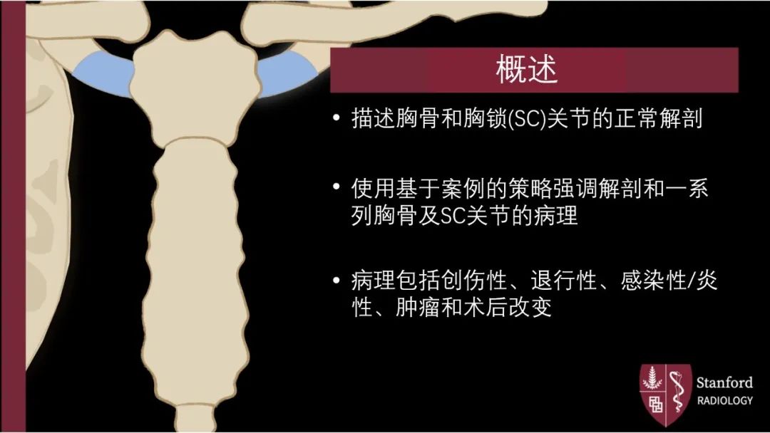 影像PPT - 【PPT】胸骨与胸锁关节-2