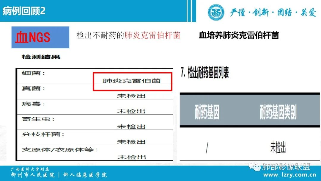 影像PPT - 【PPT】 高毒力肺炎克雷伯杆菌感染的特点-20 影像PPT - 【PPT】 高毒力肺炎克雷伯杆菌感染的特点-20