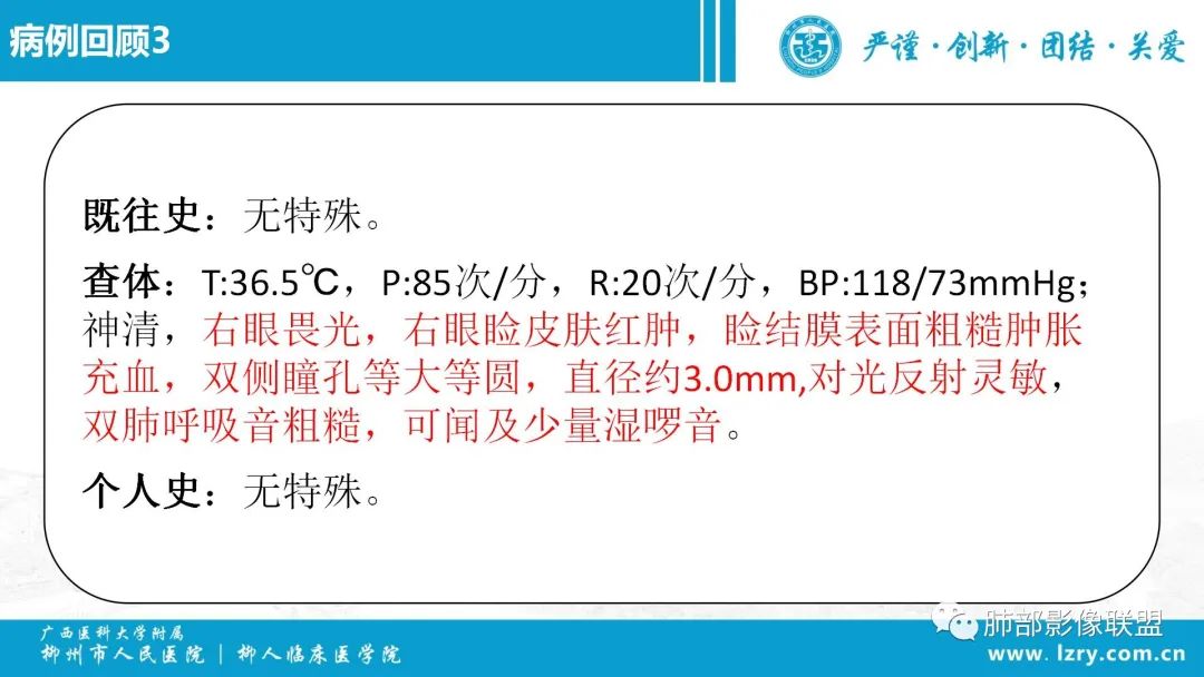 影像PPT - 【PPT】 高毒力肺炎克雷伯杆菌感染的特点-23 影像PPT - 【PPT】 高毒力肺炎克雷伯杆菌感染的特点-23