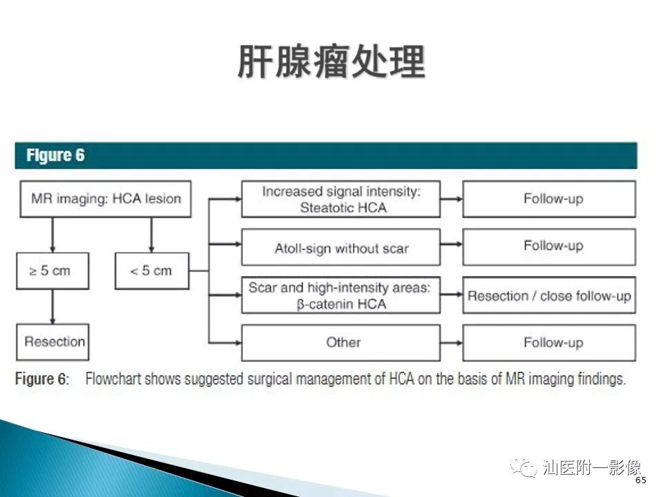 影像PPT - 【PPT】肝腺瘤再认识-65