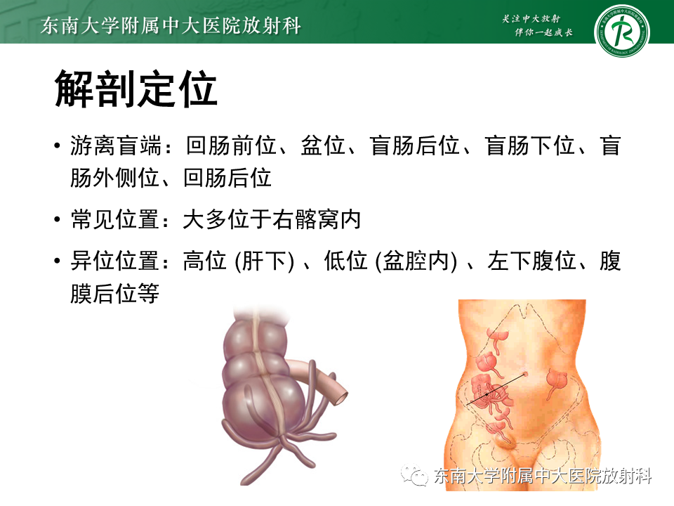 影像PPT - 【PPT】阑尾炎的CT诊断-7