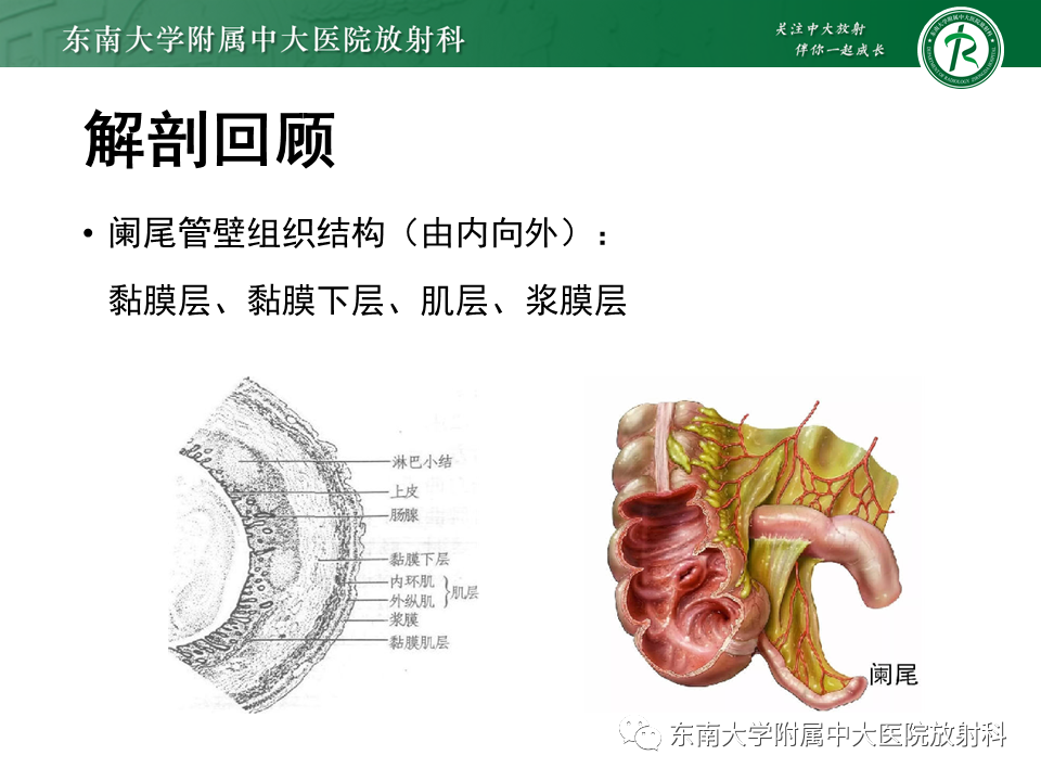 影像PPT - 【PPT】阑尾炎的CT诊断-6