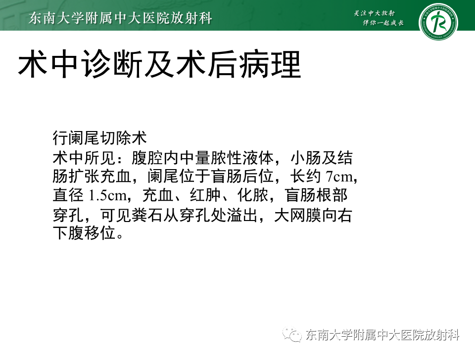 影像PPT - 【PPT】阑尾炎的CT诊断-2