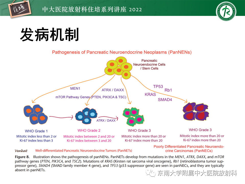 影像PPT - 【PPT】胰腺神经内分泌肿瘤的影像诊断及鉴别-4
