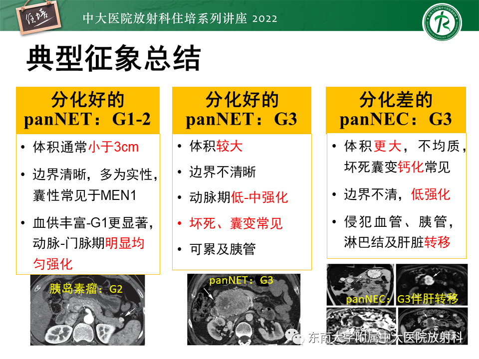 影像PPT - 【PPT】胰腺神经内分泌肿瘤的影像诊断及鉴别-35
