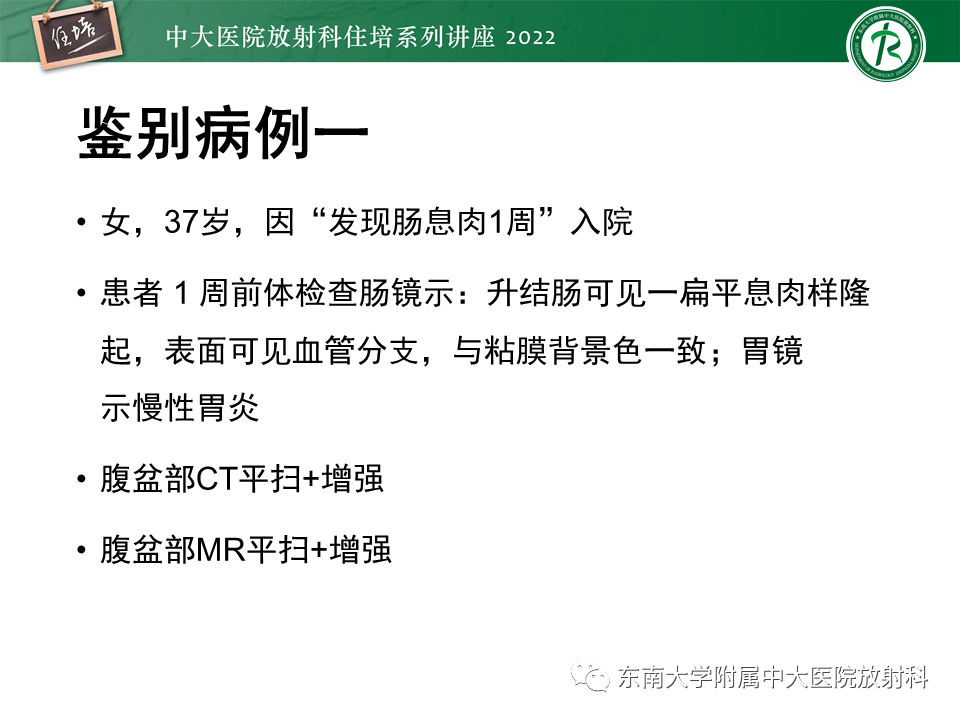 影像PPT - 【PPT】胰腺神经内分泌肿瘤的影像诊断及鉴别-40