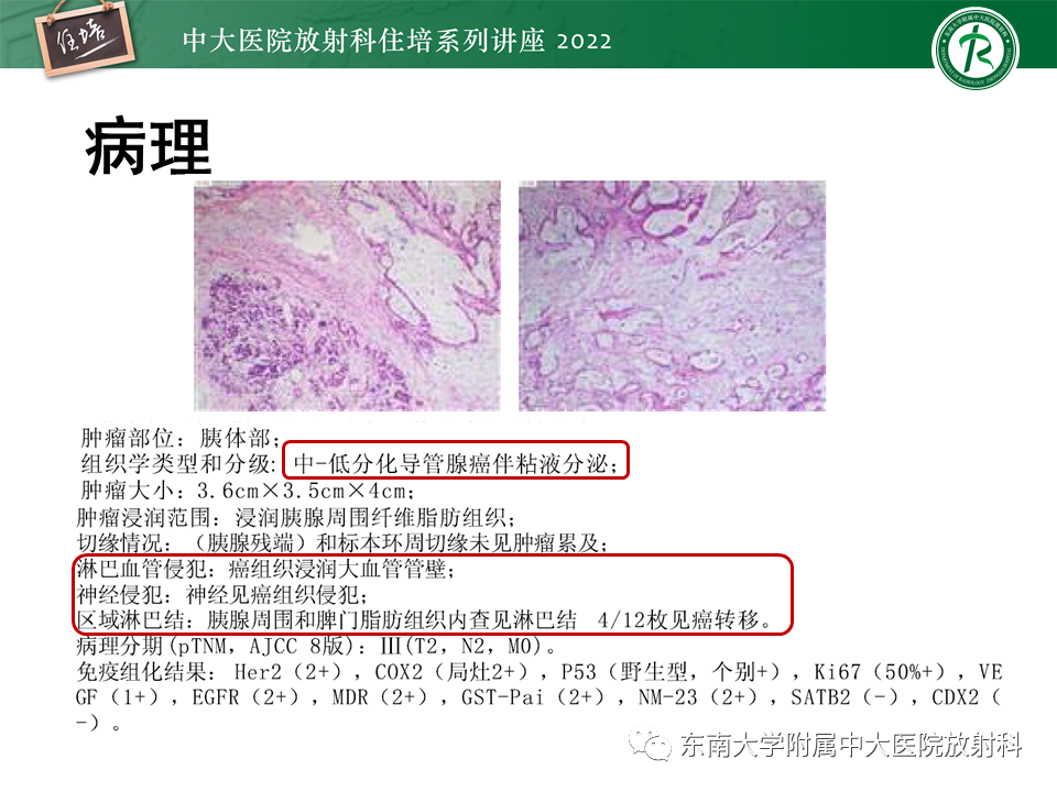 影像PPT - 【PPT】胰腺神经内分泌肿瘤的影像诊断及鉴别-49