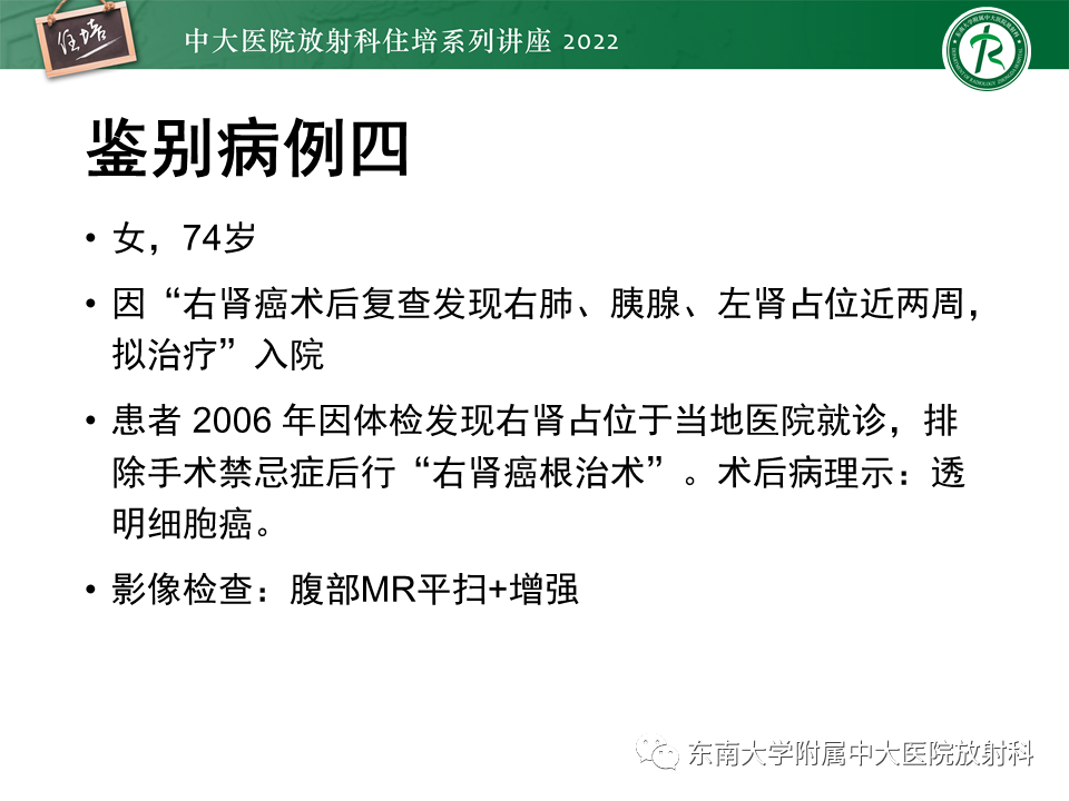 影像PPT - 【PPT】胰腺神经内分泌肿瘤的影像诊断及鉴别-58