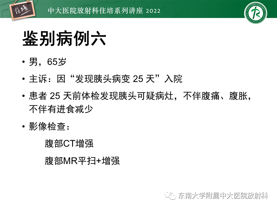 影像PPT - 【PPT】胰腺神经内分泌肿瘤的影像诊断及鉴别-66