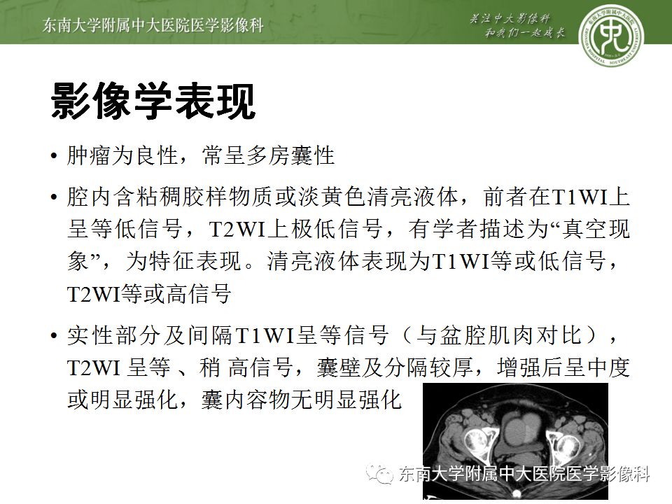 影像PPT - 【病例】卵巢成熟畸胎瘤1例CT及MR影像-22