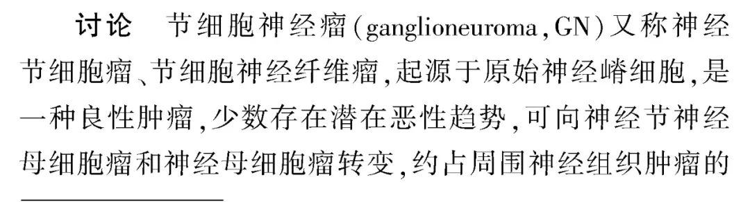 影像PPT - 【病例】原发性腹膜后肿物—节细胞神经瘤1例影像诊断思维-6