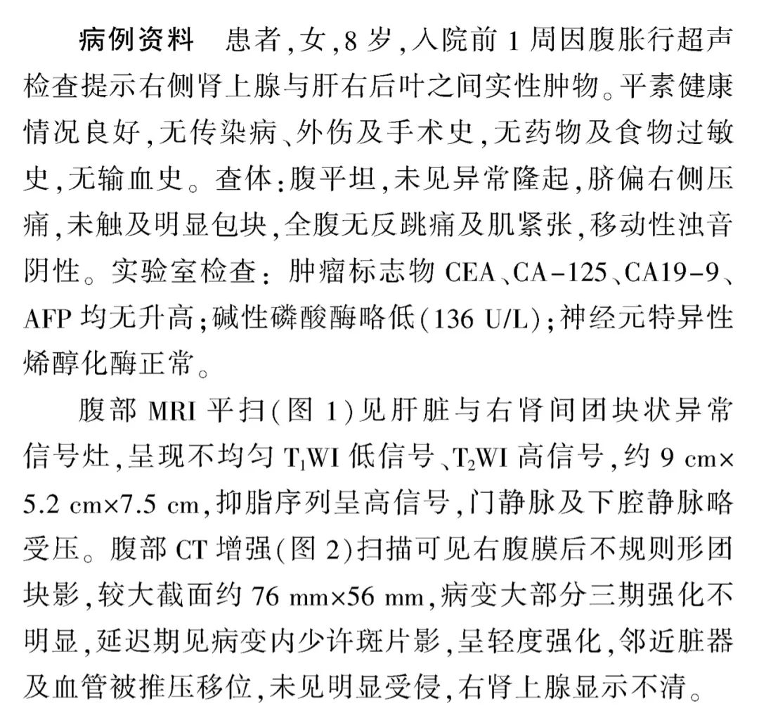 影像PPT - 【病例】原发性腹膜后肿物—节细胞神经瘤1例影像诊断思维-3