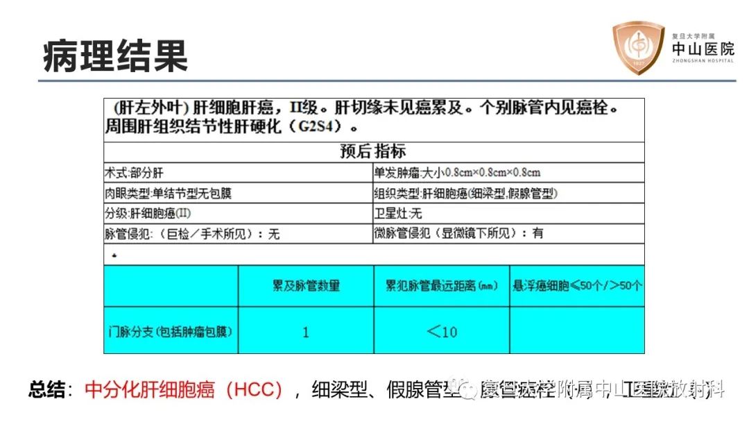 影像PPT - 【病例】微小肝癌1例MR影像-6
