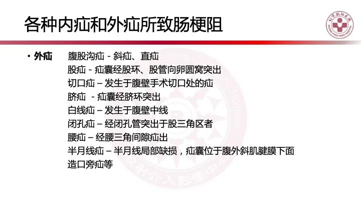 影像PPT - 【PPT】急性弥漫性腹痛-肠梗阻-11