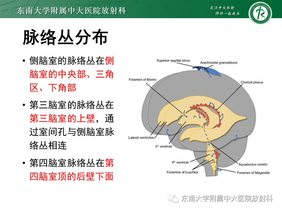 影像PPT - 【PPT】脉络丛乳头状瘤-6 影像PPT - 【PPT】脉络丛乳头状瘤-6