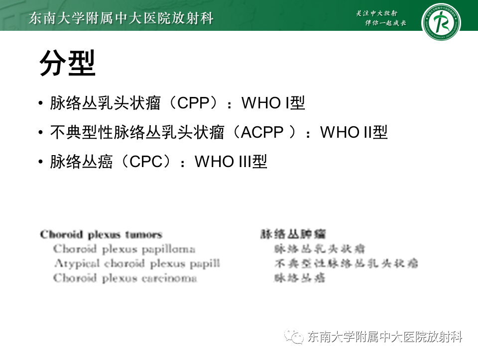影像PPT - 【PPT】脉络丛乳头状瘤-9 影像PPT - 【PPT】脉络丛乳头状瘤-9