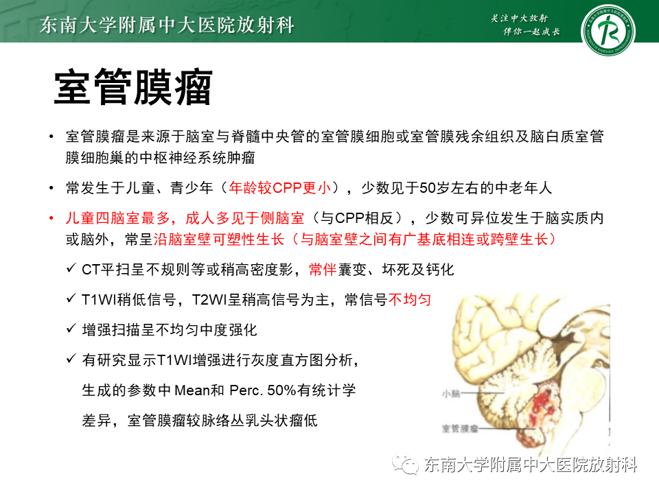 影像PPT - 【PPT】脉络丛乳头状瘤-27 影像PPT - 【PPT】脉络丛乳头状瘤-27