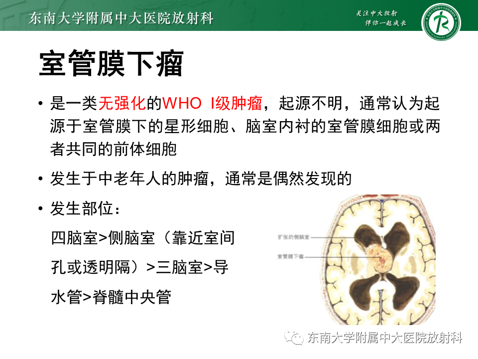 影像PPT - 【PPT】脉络丛乳头状瘤-31 影像PPT - 【PPT】脉络丛乳头状瘤-31