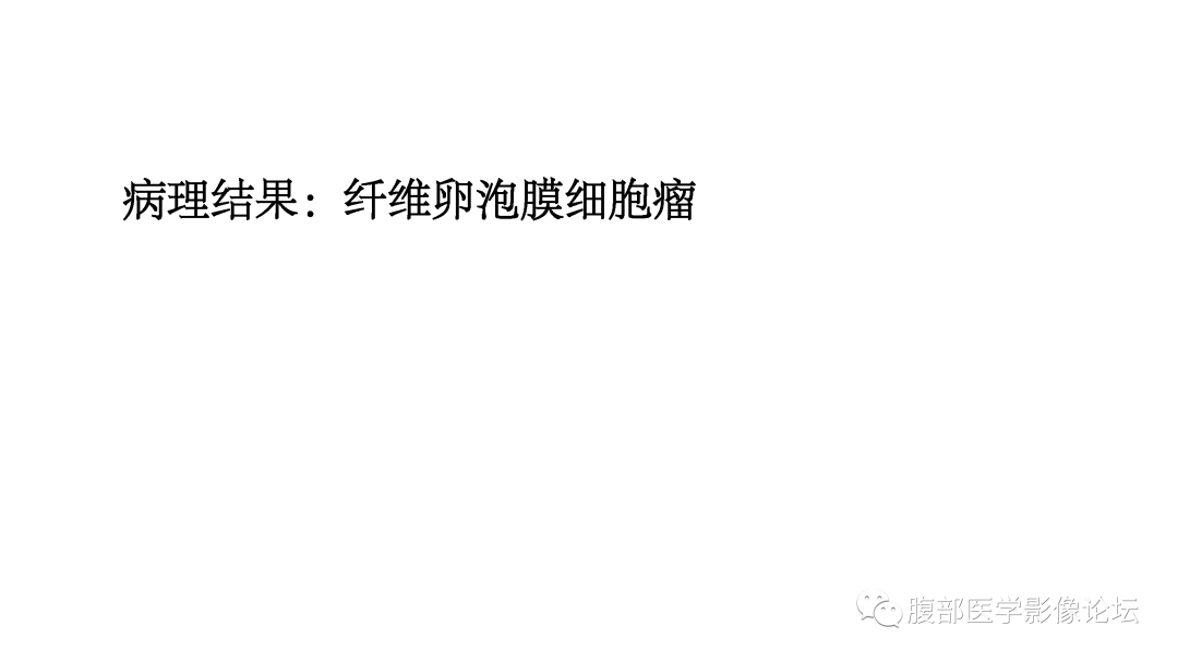 影像PPT - 【病例】纤维卵泡膜细胞瘤1例MR-8