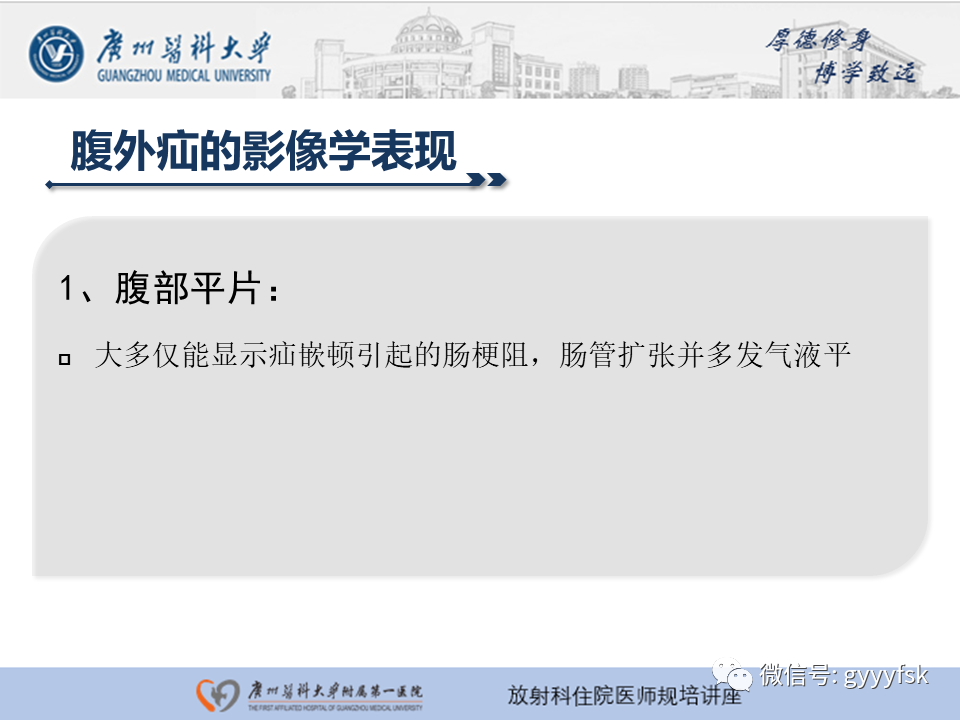 影像PPT - 【PPT】腹外疝的影像诊断-7