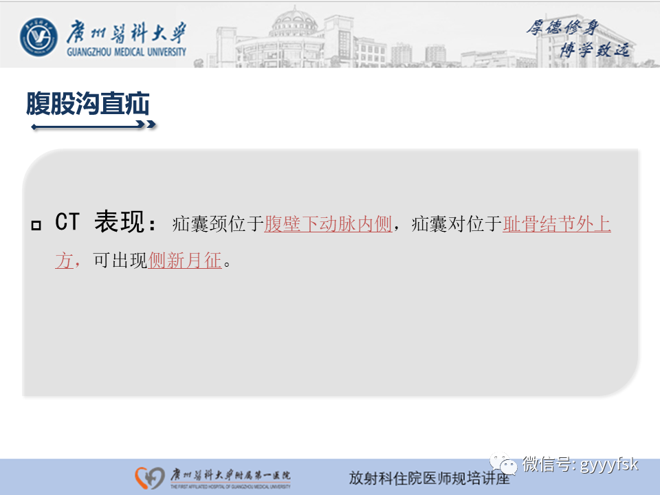 影像PPT - 【PPT】腹外疝的影像诊断-22