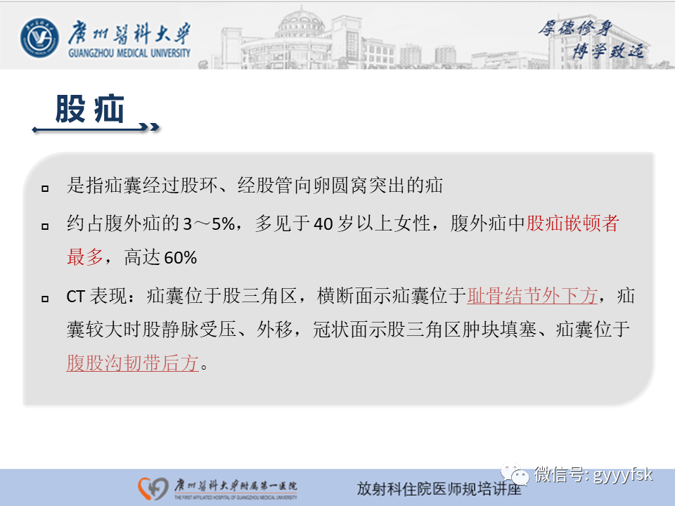 影像PPT - 【PPT】腹外疝的影像诊断-28