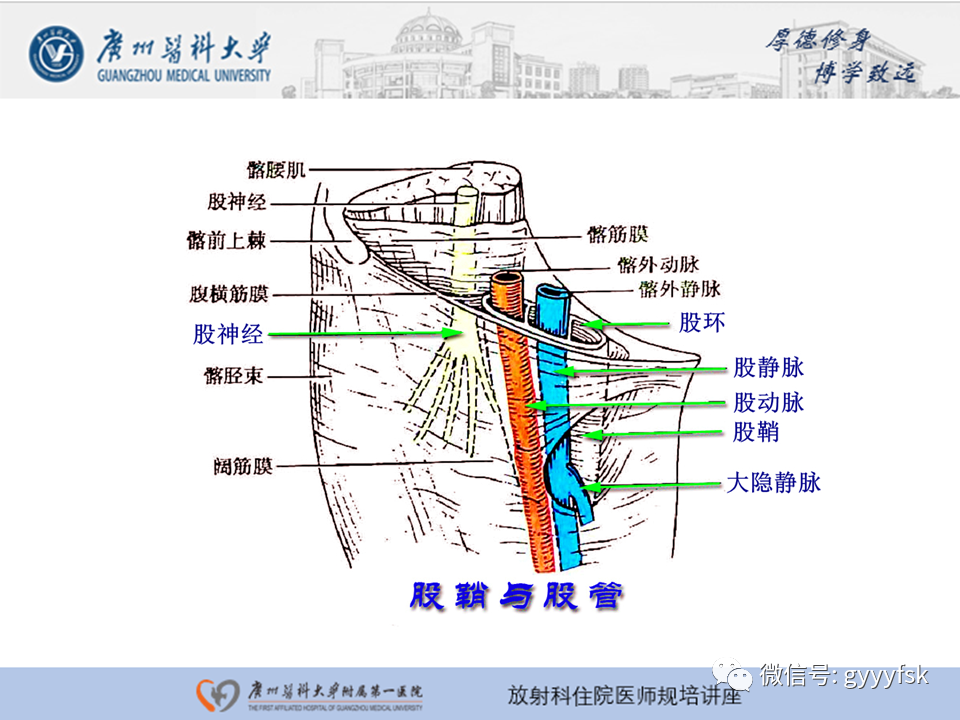 影像PPT - 【PPT】腹外疝的影像诊断-29