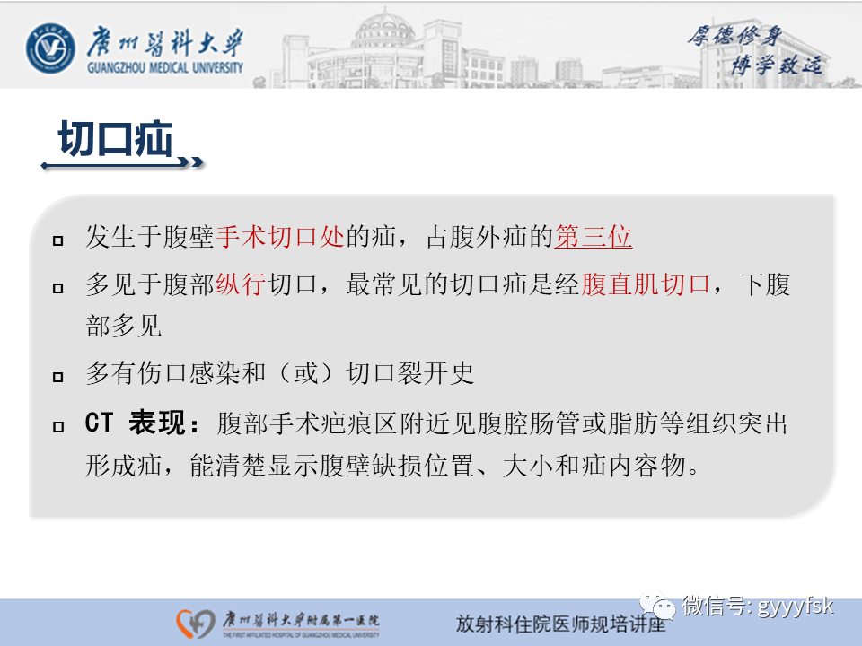 影像PPT - 【PPT】腹外疝的影像诊断-35
