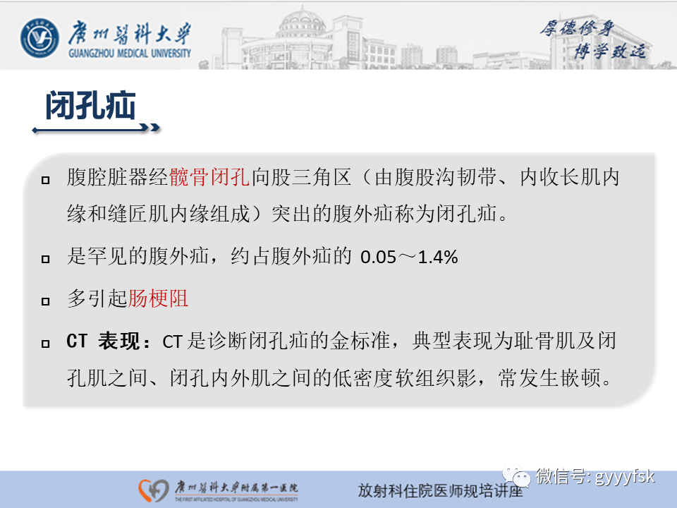 影像PPT - 【PPT】腹外疝的影像诊断-47