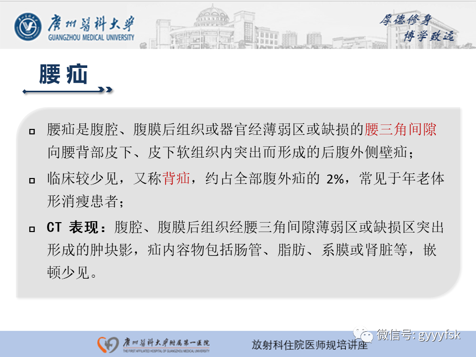 影像PPT - 【PPT】腹外疝的影像诊断-52