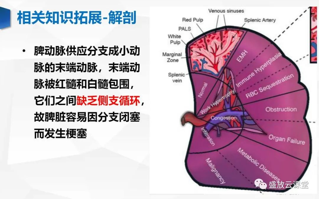影像PPT - 【病例】脾脏淋巴瘤1例CT影像鉴别诊断-21 影像PPT - 【病例】脾脏淋巴瘤1例CT影像鉴别诊断-21